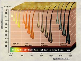 EpiLight broad spectrum for treating all hair colors from the entire body